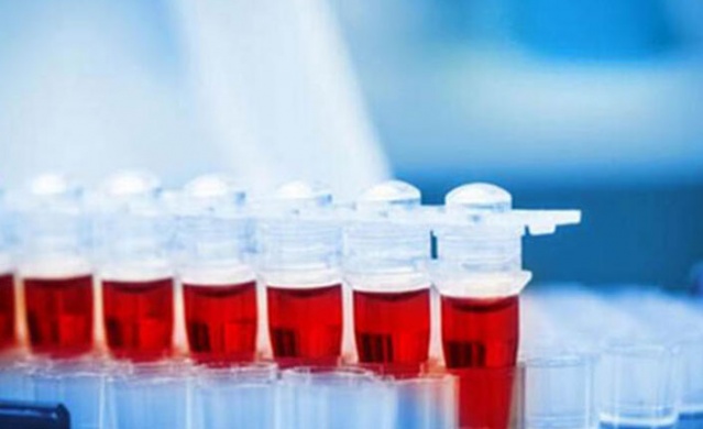 Kansere karşı en dirençli kan grubu açıklandı 4
