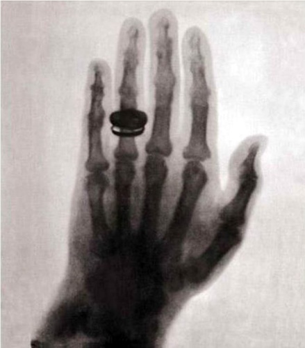 124 yıl önce çekilen ilk röntgendeki ilginç detay ortaya çıktı! 2