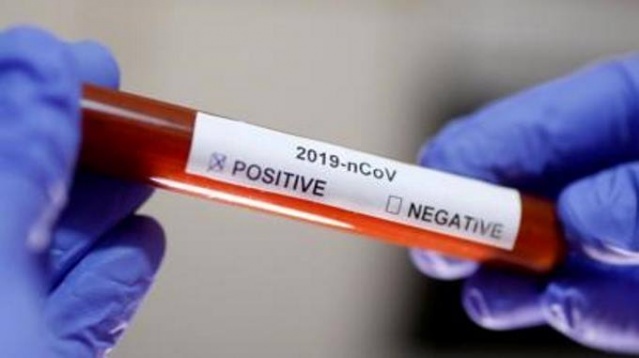 Kan gruplarına göre koronavirüs bulaşma riski! 5