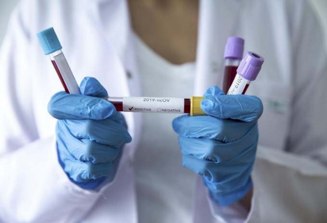 Kan gruplarına göre koronavirüs bulaşma riski! 4