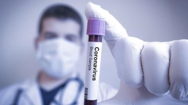 Kan gruplarına göre koronavirüs bulaşma riski! 7