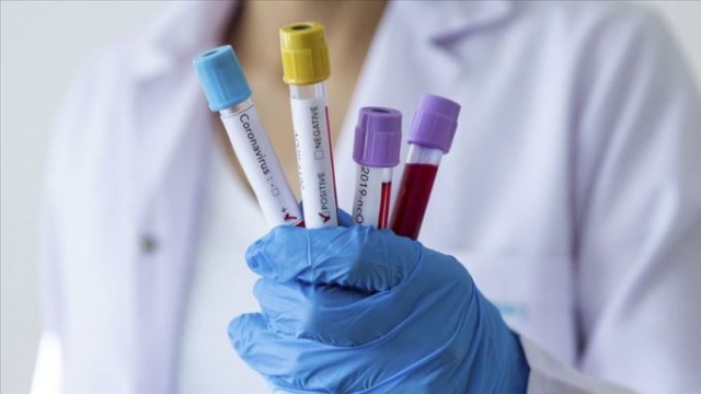Avustralya koronavirüsle savaş için tüberküloz aşısını test edecek 2