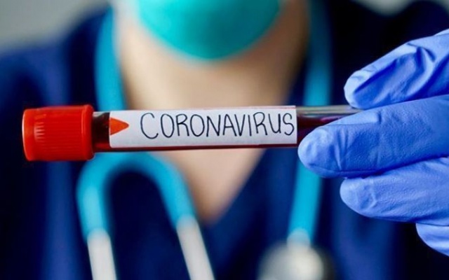 Koronavirüse karşı umutlandıran açıklama 5