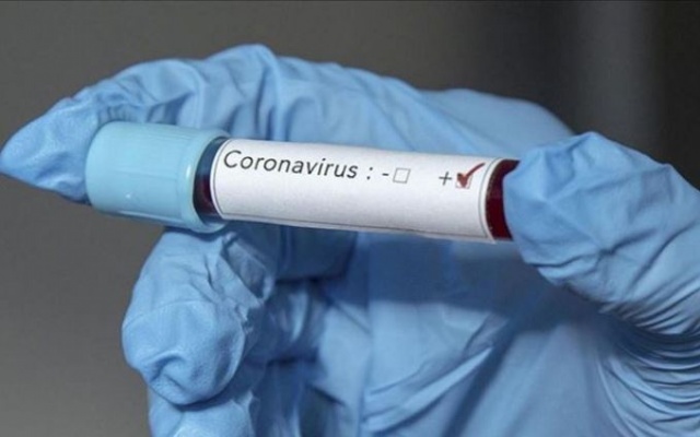 Koronavirüse karşı umutlandıran açıklama 3
