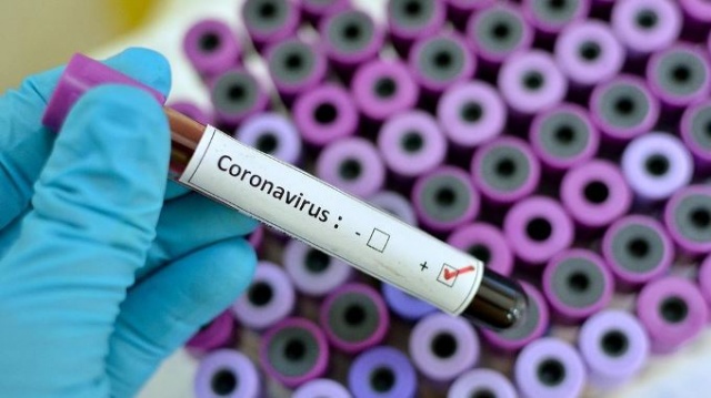 Koronavirüsün zayıf noktası bulundu 4