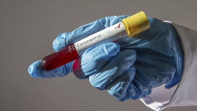 Koronavirüste 27 gün detayı 8
