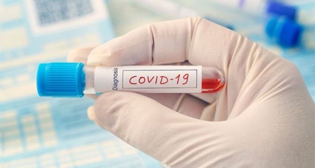 Koronavirüse karşı en şanslı kan grubu hangisi? 3