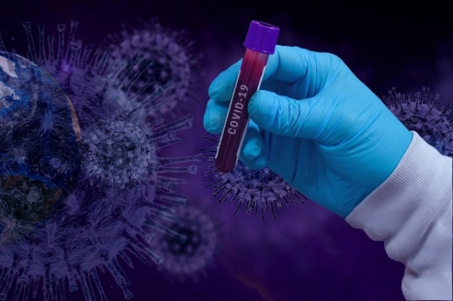 Bilim insanlarından koronavirüsü bitirecek keşif 6