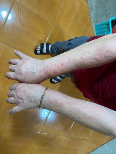 Rize'de yaylaya dolu yağdı; 1 kişi yaralandı. Foto Haber 3