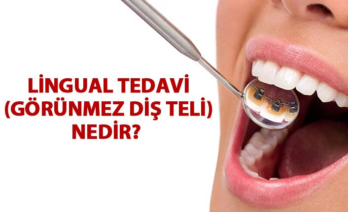 Lingual tedavi (görünmez diş teli) nedir?