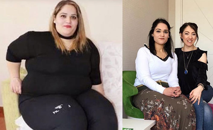 Fil hastası Gamze 15 ayda 163 kilo verdi
