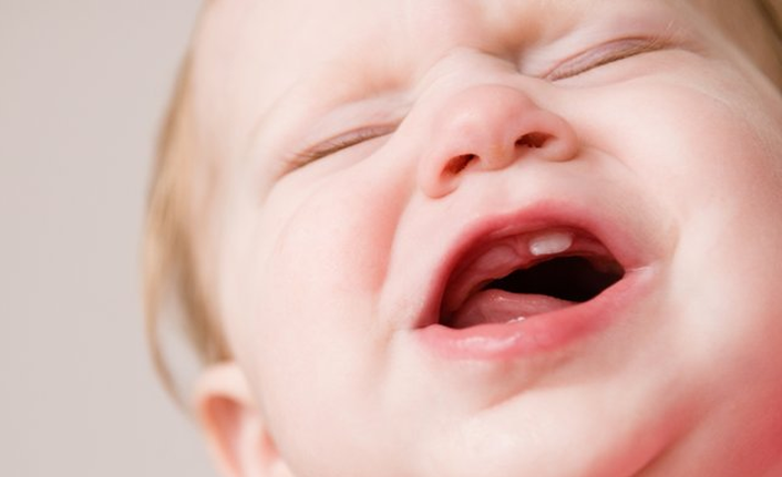 Bebeklerde görülen diş problemlerine dikkat!