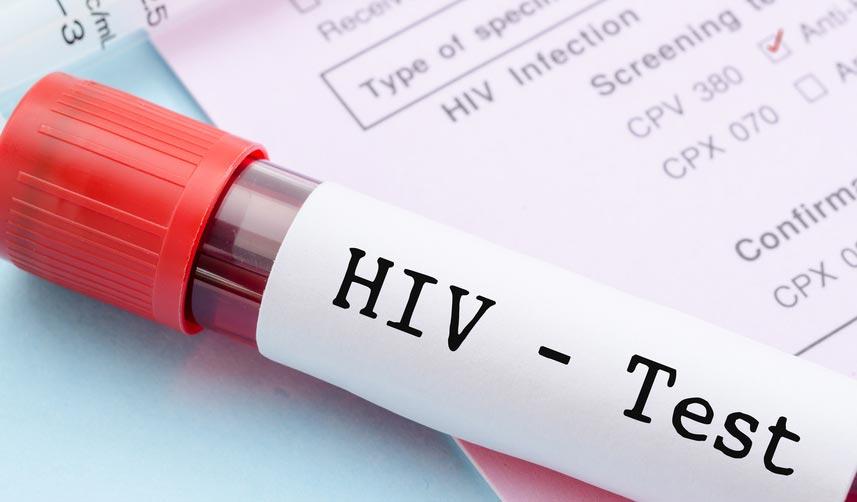 AIDS nedir? Belirtileri nelerdir? Hangi yollarla bulaşır?
