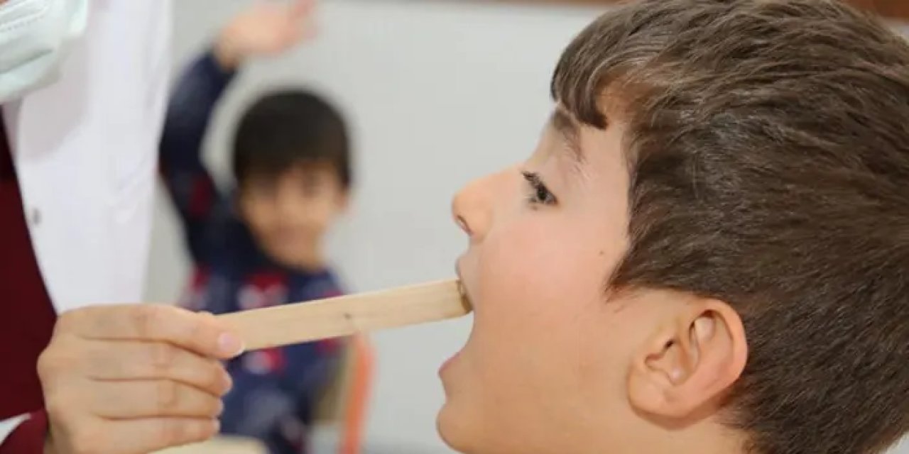 Samsun'da okullara diş taraması! Öğrencilerin yüzde 42'sinde çürük diş çıktı