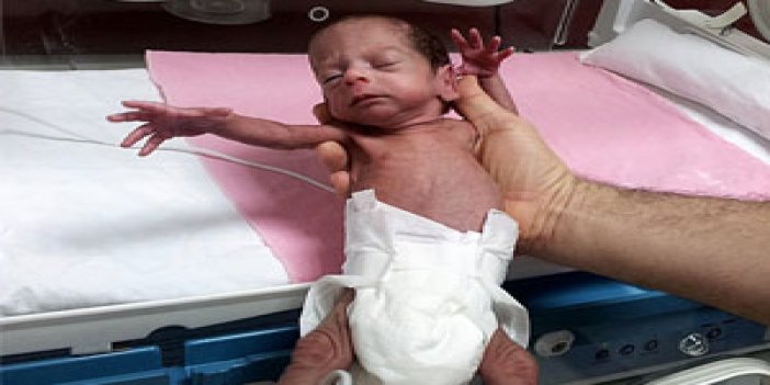 Trabzon'da mucize bebek hayata tutundu