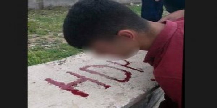 Dövdükleri çocuğun kanıyla HDP yazdılar