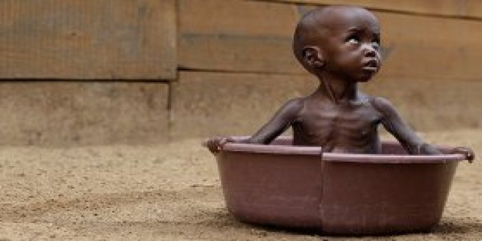Somali’de 48 saatte 100 kişi açlıktan öldü