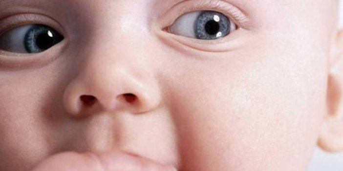 Bebeklerde göz kaymasına dikkat