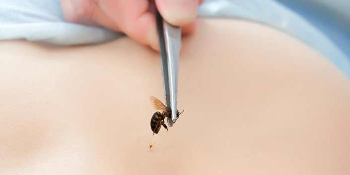 Karadeniz’e arı alerjisi uyarısı!