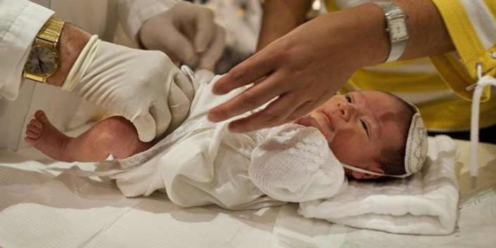 Erken dönem sünnet için en doğru zaman: İlk 6 ay