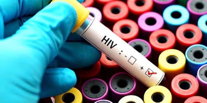 Türkiye’de HIV virüsü en sık o yaşlar arasında görülüyor!