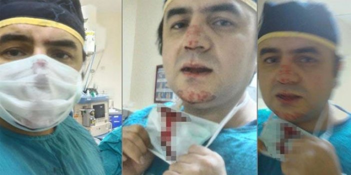 Osmaniye’de doktoru darp edip burnunu kıran saldırgan tutuklandı