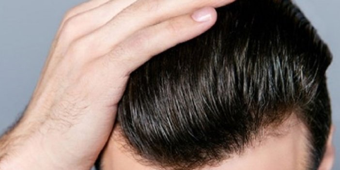 Saç ektirenlerin bilmesi gereken önemli hususlar
