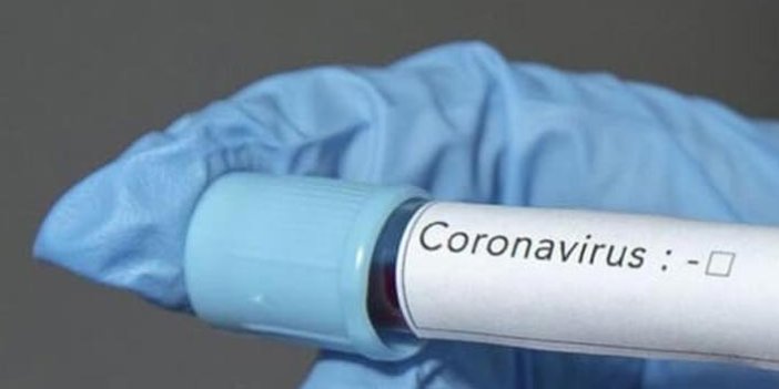 Uzmanından açıklama geldi! Koronavirüs Türkiye'de salgına neden olamaz