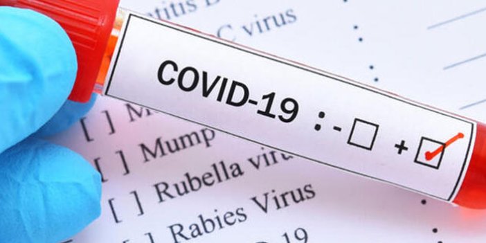 KKTC’de koronavirüs vakası 38 oldu