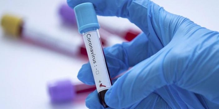 Rize'de koronavirüse karşı yeni birim hizmete başlıyor