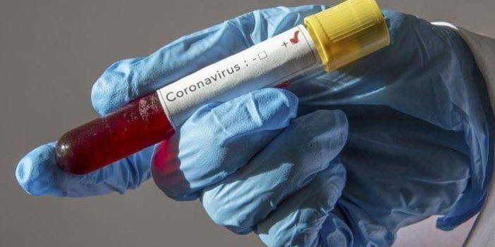 KTÜ'lü Profesör'den koronavirüs ilacı uyarısı