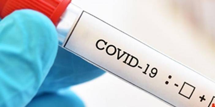 13 yaşındaki çocuk koronavirüs nedeniyle öldü 31 Mart 2020