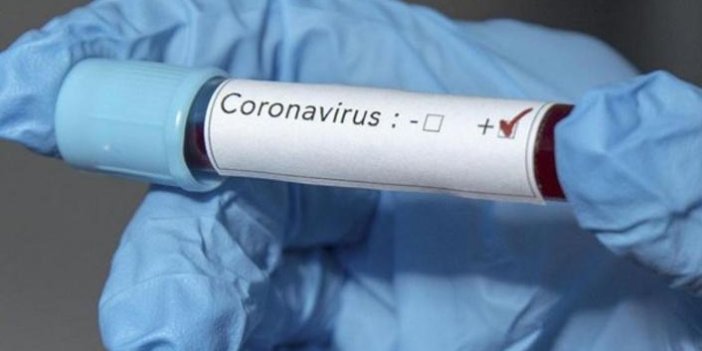 Avrupa'da koronavirüs nedeniyle 108 Türk hayatını kaybetti