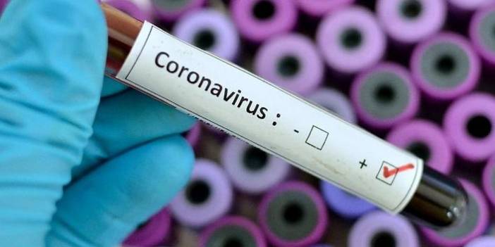 65 Türk'ün koronavirüs testi pozitif çıktı