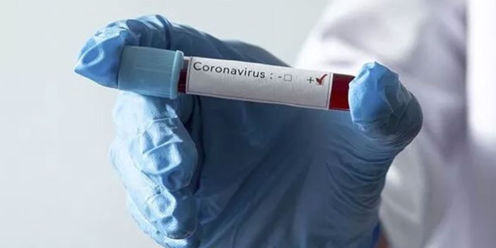 Koronavirüs aşısını bulduk diyen Rusya'dan flaş açıklama