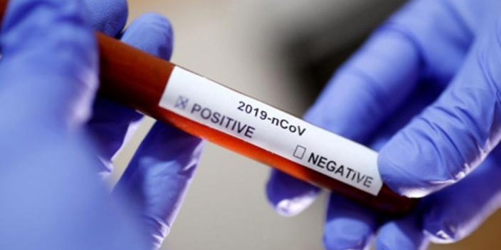 Bilim insanları koronavirüsün zayıf noktasını buldu