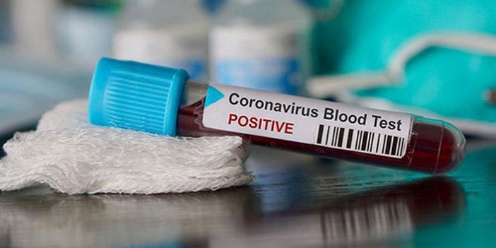 Almanya'da koronavirüsten ölenlerin sayısı arttı