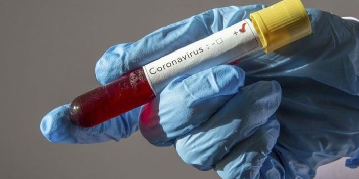 Profesörün koronavirüsü Çin’e sattığı iddiası yalanlandı