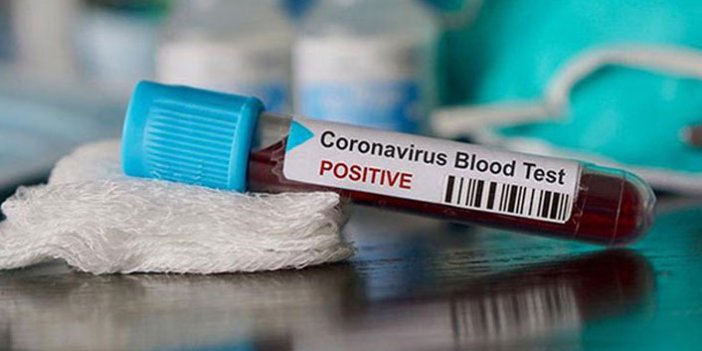 Dünya genelinde koronavirüs bilançosu: Ölü sayısı 170 bin 482