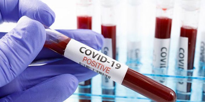 İtalyan bilim insanlarından kritik koronavirüs raporu