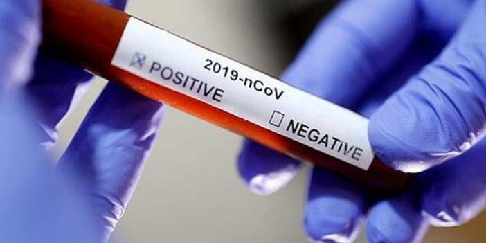 Trabzon için güzel haber! KTÜ'deki koronavirüs testlerinde...