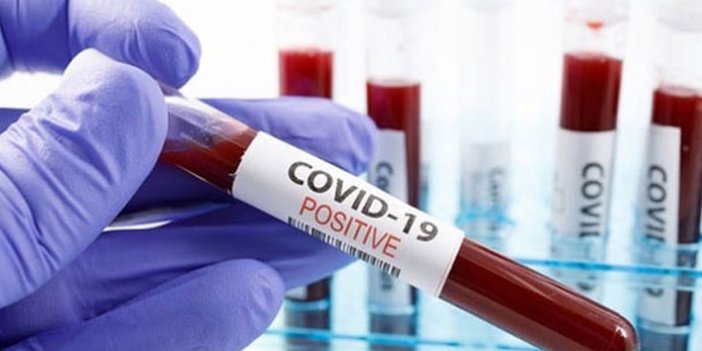 Türkiye'deki koronavirüs vakaları hakkındaki ilk bilimsel yayın çıktı