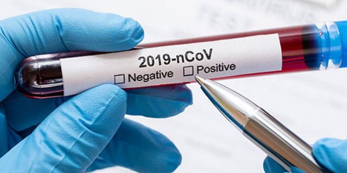 Dünya genelinde koronavirüsten can kaybı 320 bini geçti