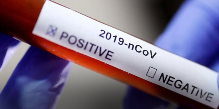 Güncel Koronavirüs rakamları açıklandı! Uzun bir aradan son bir ilk yaşandı