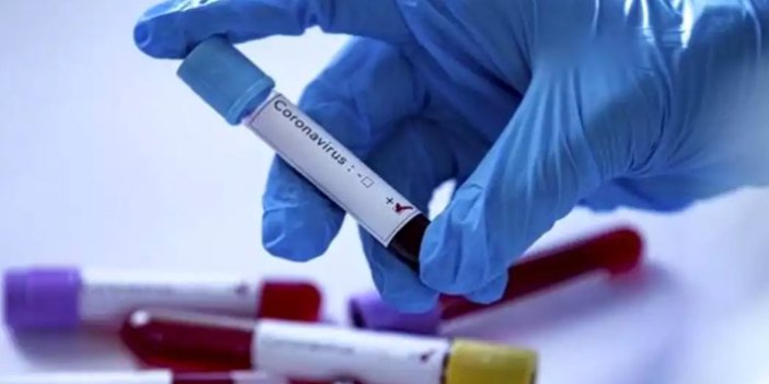 Trabzon’da koronavirüs antikor testleri yapılmaya başlandı