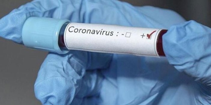 Önemli ilaç açıklaması! Koronavirüste iyileşmeyi hızlandırıyor