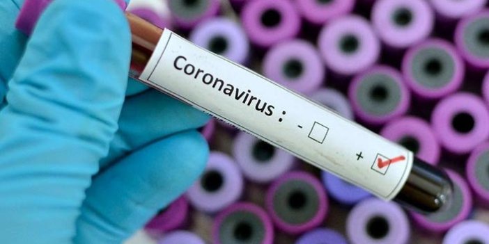 Koronavirüsün bu belirtisi ilk kez Türkiye'de görüldü