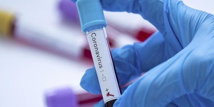 Türk bilim insanları geliştirdi! Koronavirüsü 10 saniyede tespit ediyor