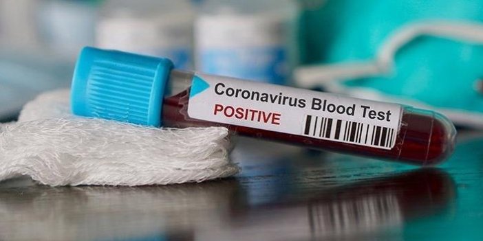 Bakan Koca açıkladı! 15 kişide mutasyonlu koronavirüs tespit edildi