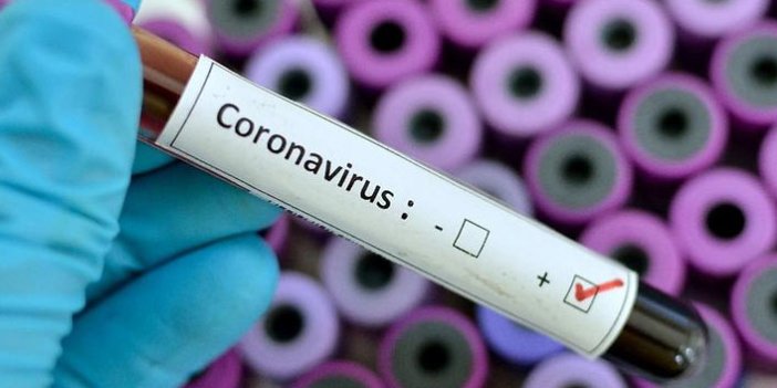 Türkiye'nin günlük koronavirüs tablosu açıklandı